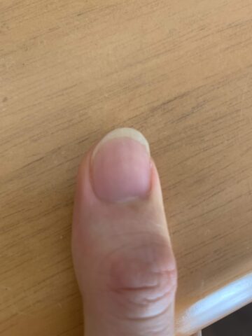 クラシックギター用の親指の爪の形