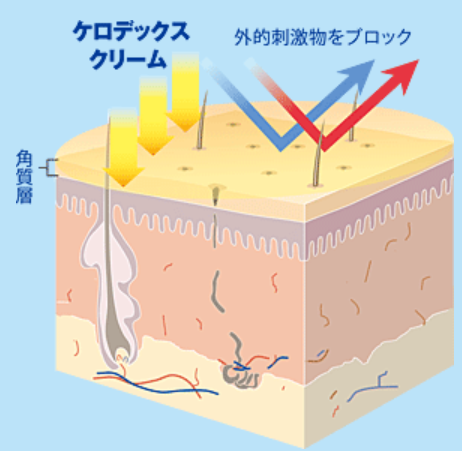 ケロデックスクリームで肌荒れから守る